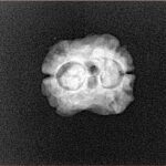 2 Mukhi Rudraksha 20.1mm 1.64gm - Xray