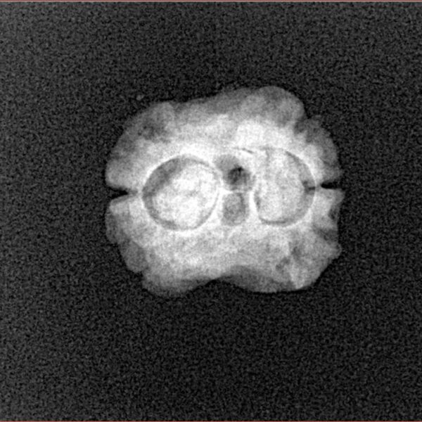 2 Mukhi Rudraksha 20.1mm 1.64gm - Xray