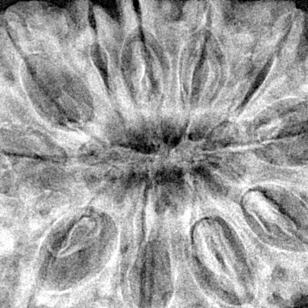 11 Mukhi Rudraksha 38.4mm 10.63gm - Xray