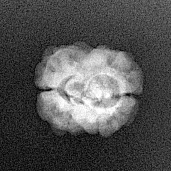 2 Mukhi Rudraksha 22.2mm 1.52gm - Xray