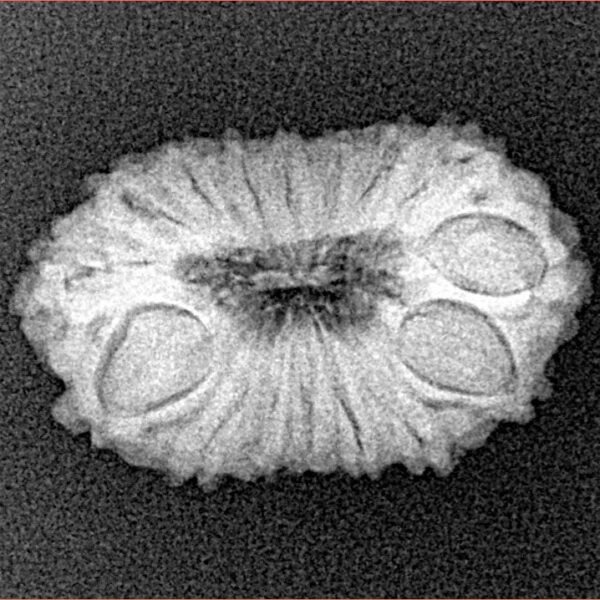 16 Mukhi Rudraksha 22.4mm 2.07gm - Xray