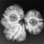 Sawar/Ganesh (2+1) 22.2mm 3gm - Xray