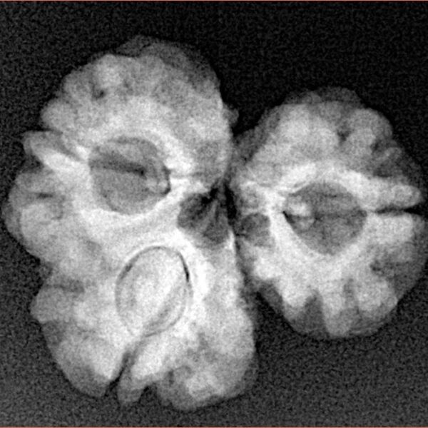 Sawar/Ganesh (2+1) 22.2mm 3gm - Xray