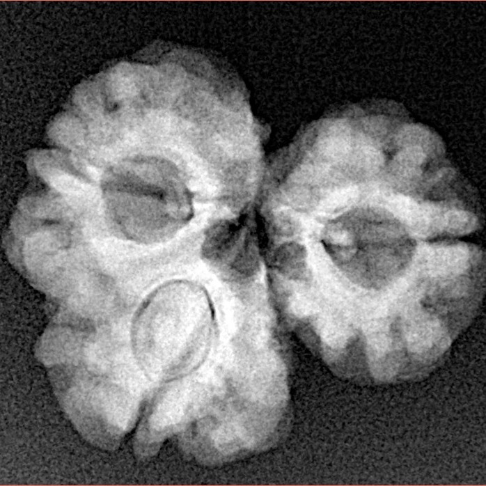 Sawar/Ganesh (2+1) 22.2mm 3gm - Xray