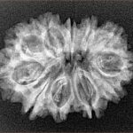 11 Mukhi Rudraksha 27mm 3.14gm - Xray