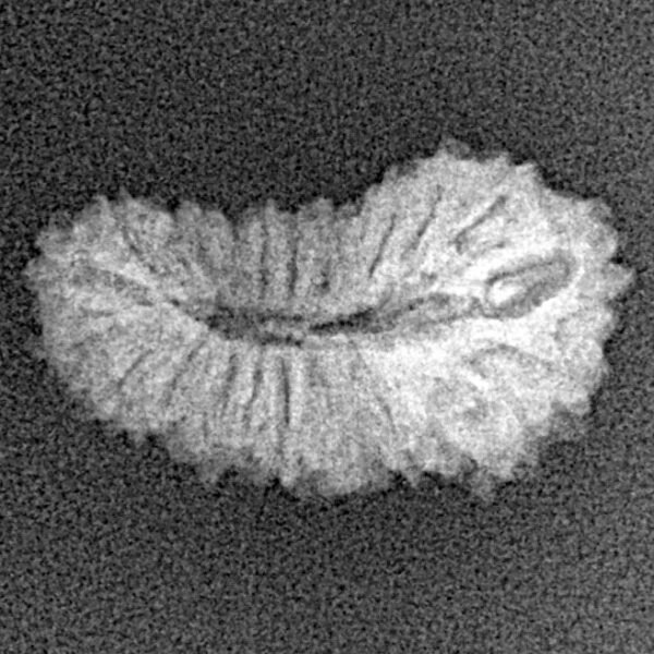 21 Mukhi Rudraksha 19.8mm 1.08gm - Xray