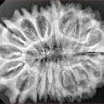 17 Mukhi Rudraksha 32.6mm 5gm - Xray