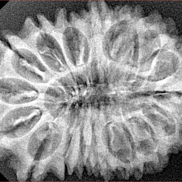 17 Mukhi Rudraksha 32.6mm 5gm - Xray
