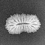 20 Mukhi Rudraksha 15.9mm 0.65gm - Xray