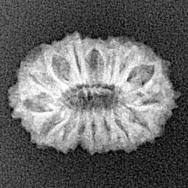 16 Mukhi Rudraksha 18.1mm 1.32gm - Xray