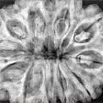 11 Mukhi Rudraksha 34.6mm 9gm - Xray