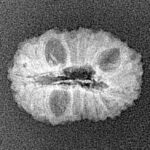 16 Mukhi Rudraksha 19.2mm 1gm - Xray