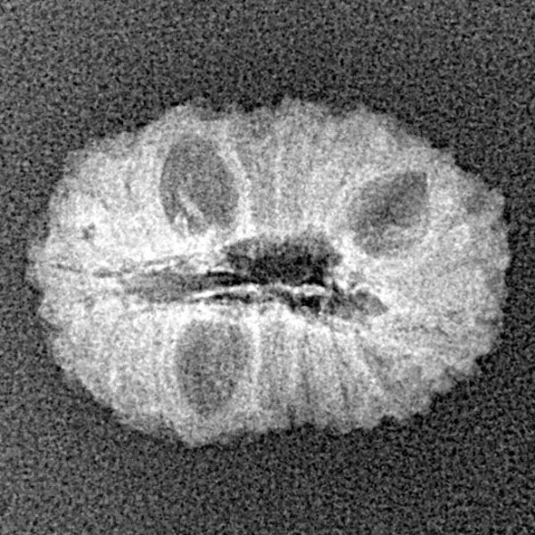 16 Mukhi Rudraksha 19.2mm 1gm - Xray