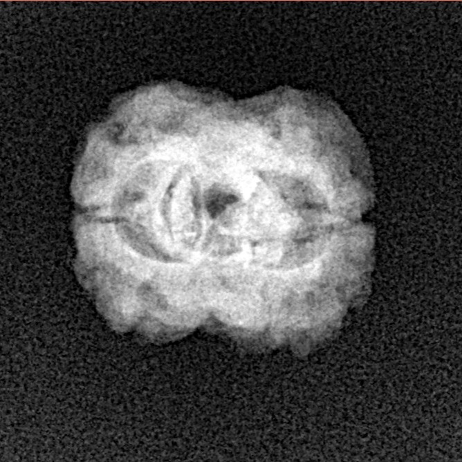 2 Mukhi Rudraksha 23.3mm 1.74gm - Xray