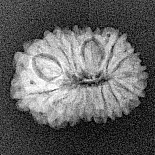 15 Mukhi Rudraksha 19.2mm 1.44gm - Xray