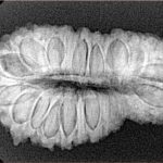 31 Mukhi Rudraksha 32.5mm 4.52gm - Xray
