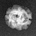 2 Mukhi Rudraksha 17.3mm 0.85gm - Xray