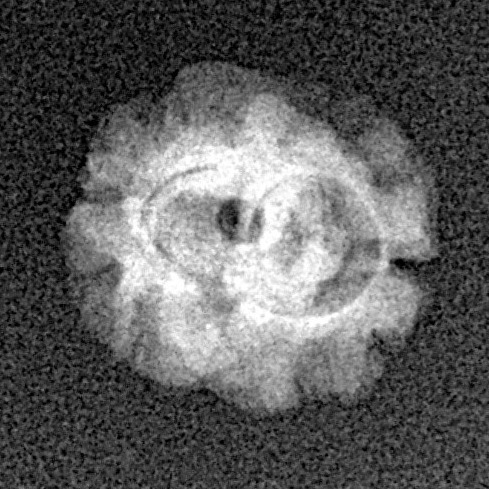 2 Mukhi Rudraksha 17.3mm 0.85gm - Xray