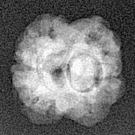 2 Mukhi Rudraksha 16.7mm 1.15gm - Xray