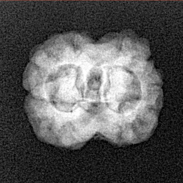 2 Mukhi Rudraksha 22.9mm 2gm - Xray