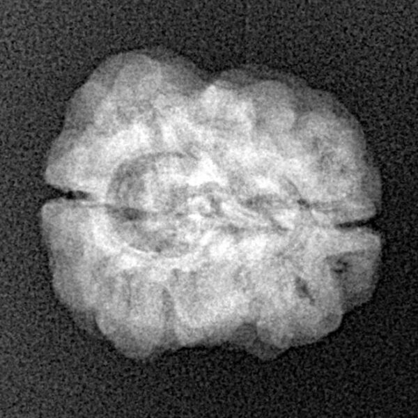 2 Mukhi Rudraksha 22.6mm 2.26gm - Xray