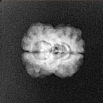 2 Mukhi Rudraksha 20.8mm 1.58gm - Xray