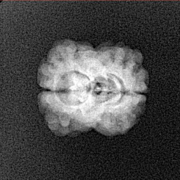 2 Mukhi Rudraksha 20.8mm 1.58gm - Xray