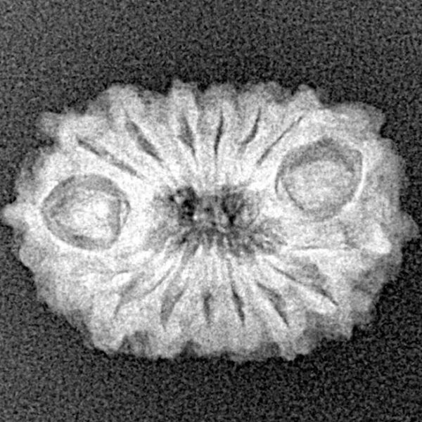 16 Mukhi Rudraksha 20.9mm 1.82gm - Xray