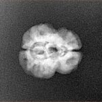 2 Mukhi Rudraksha 21.7mm 1.73gm - Xray