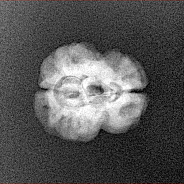 2 Mukhi Rudraksha 21.7mm 1.73gm - Xray