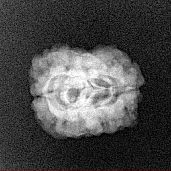 2 Mukhi Rudraksha 22.3mm 1.81gm - Xray