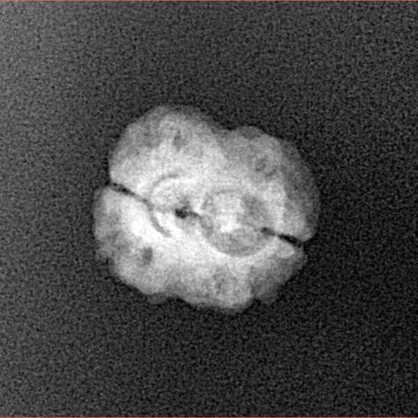 2 Mukhi Rudraksha 21.1mm 1.36gm - Xray