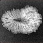 19 Mukhi Rudraksha 24.4mm 2.68gm - Xray