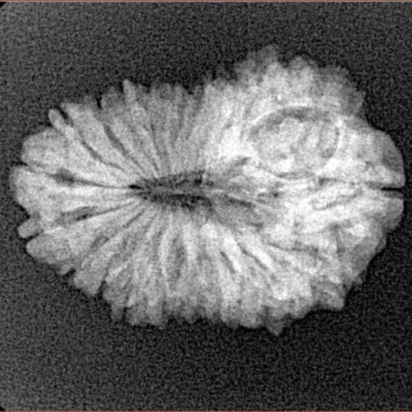 19 Mukhi Rudraksha 24.4mm 2.68gm - Xray