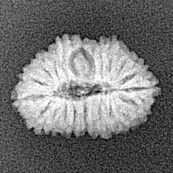 19 Mukhi Rudraksha 16.9mm 1.02gm - Xray