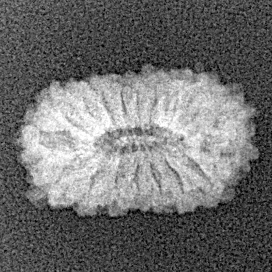 17 Mukhi Rudraksha 16.5mm 0.92gm - Xray