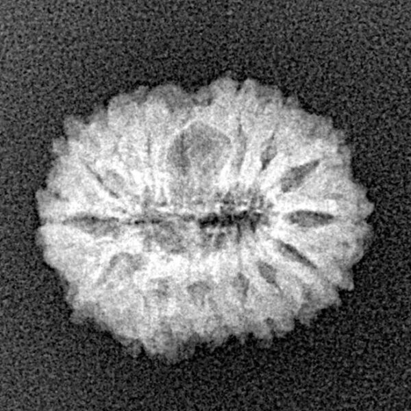 15 Mukhi Rudraksha 17.8mm 1.6gm - Xray