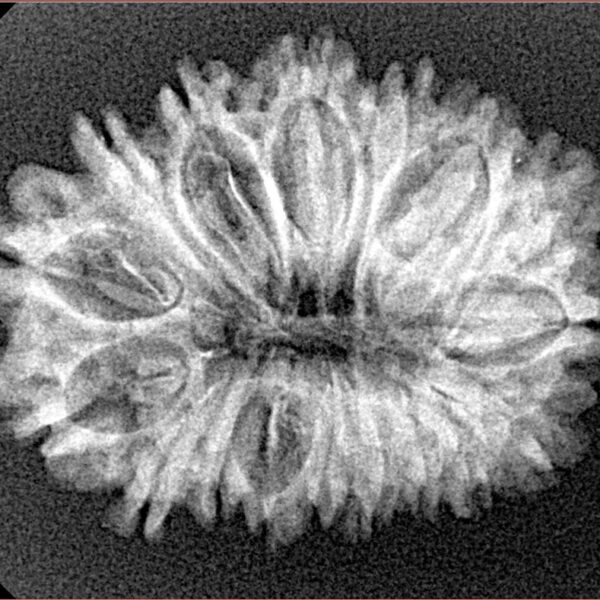17 Mukhi Rudraksha 27.8mm 3.45gm - Xray