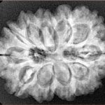 11 Mukhi Rudraksha 29.5mm 5.66gm - Xray