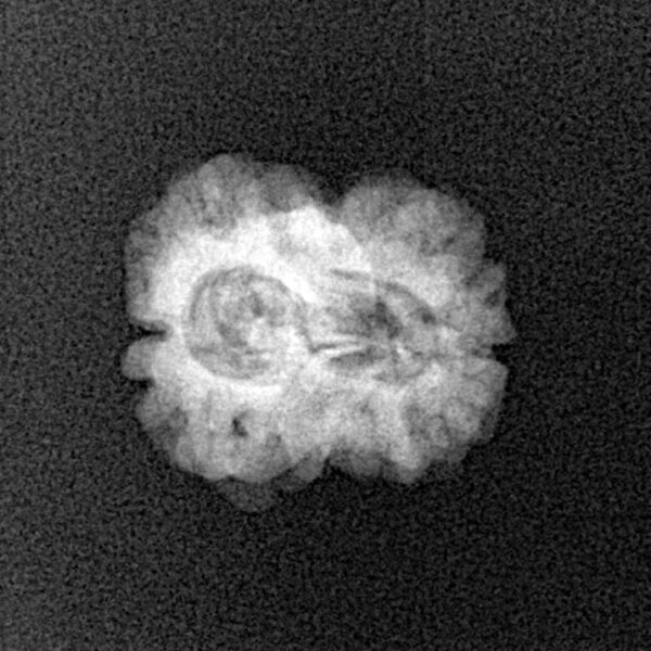 2 Mukhi Rudraksha 22.2mm 1.54gm - Xray