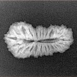 25 Mukhi Rudraksha 23.3mm 1.71gm - Xray