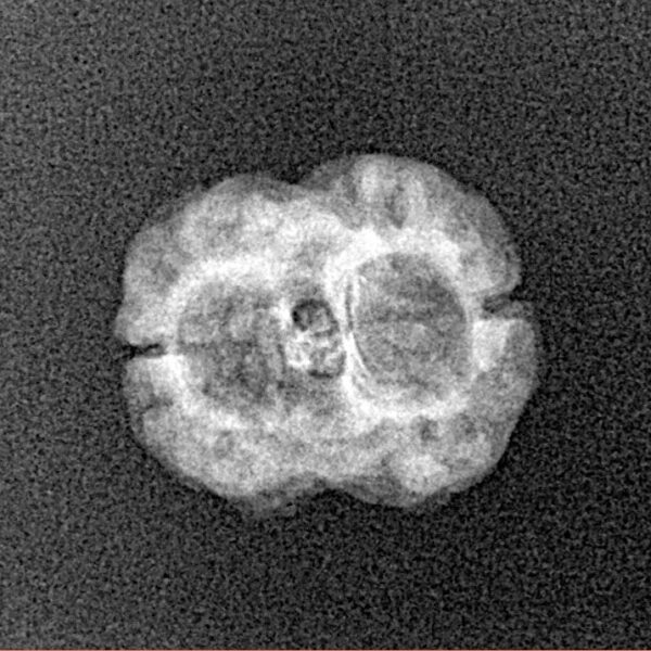 2 Mukhi Rudraksha 20.1mm 1.13gm - Xray