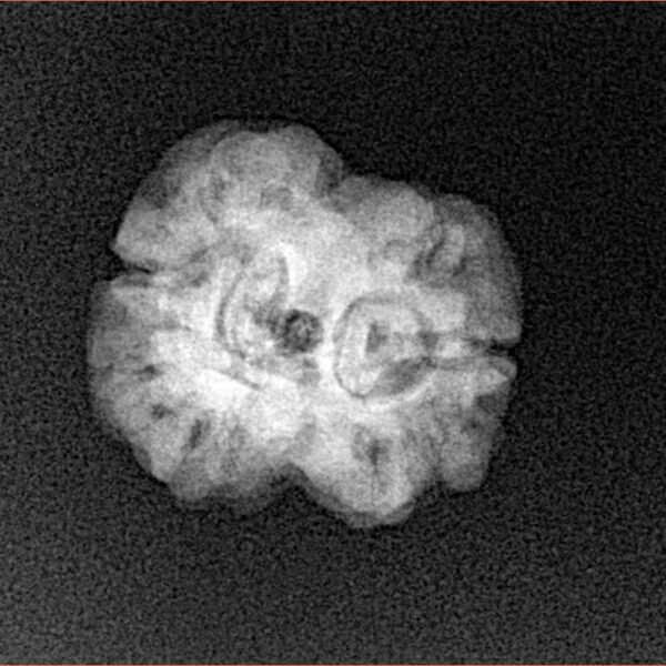 2 Mukhi Rudraksha 21.3mm 2.08gm - Xray