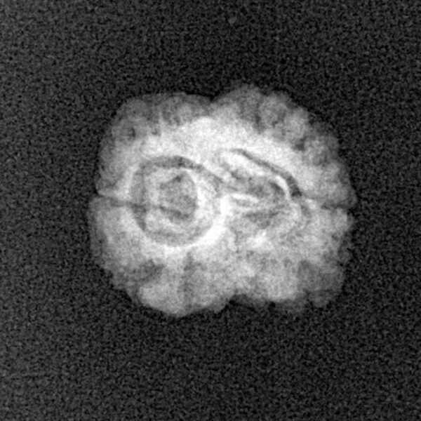 2 Mukhi Rudraksha 20.8mm 1.3gm - Xray
