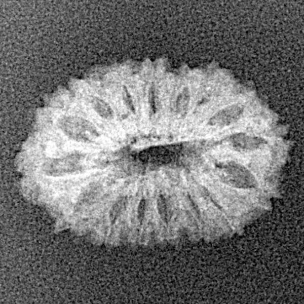 16 Mukhi Rudraksha 19.6mm 0.94gm - Xray
