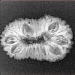 19 Mukhi Rudraksha 24.9mm 2.36gm - Xray