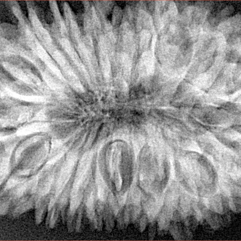 20 Mukhi Rudraksha 37.5mm 8.35gm - Xray