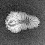 20 Mukhi Rudraksha 17.1mm 0.62gm - Xray