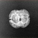 2 Mukhi Rudraksha 19.9mm 1.53gm - Xray