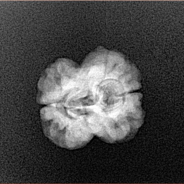 2 Mukhi Rudraksha 20.7mm 1.69gm - Xray